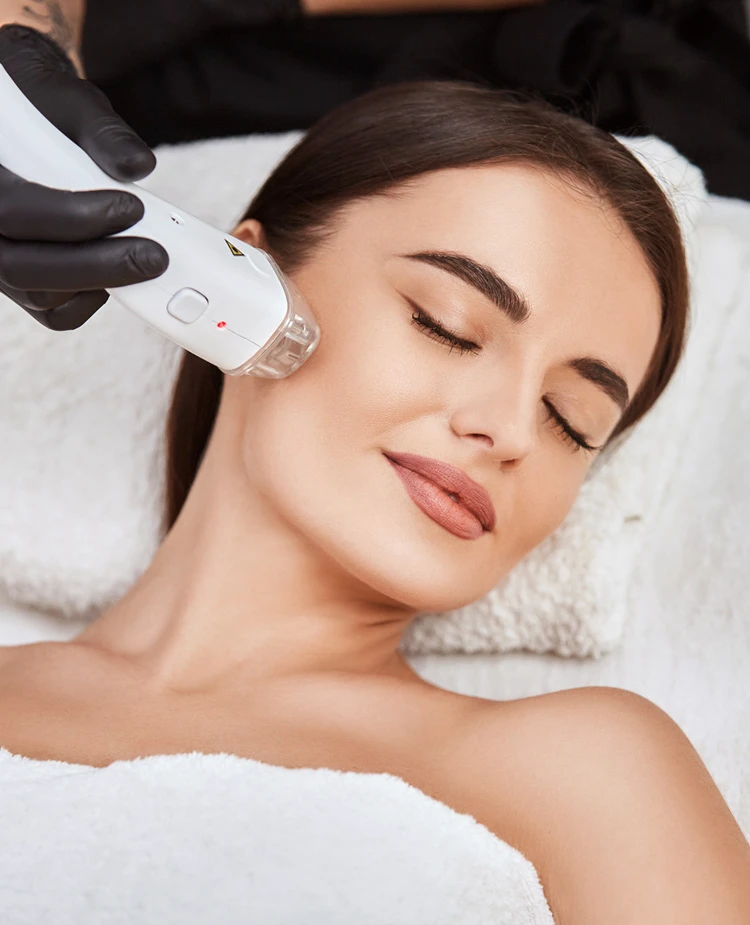 IPL photofacial- what